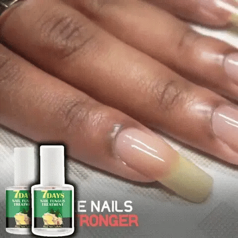 💅ENDURECEDOR DE UÑAS 4K POTENTE⭐⭐⭐⭐⭐ CRECIMIENTO🔝 & HONGOS💫