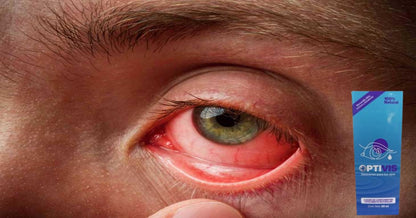 🤯🔥😎Dile Adiós A La visión Borrosa: 👀Fortalece Tus Ojos Con OPTIVIS🤯🔥😍
