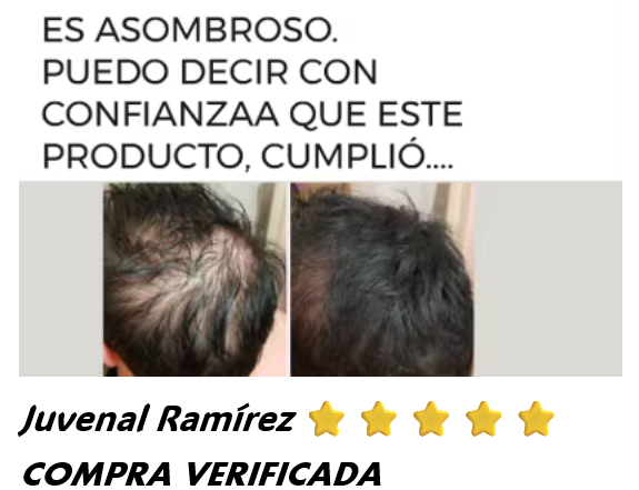 💯SERUM CAPILAR ⭐⭐⭐⭐⭐5 POTENCIAS🤩