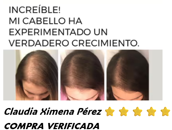 💯SERUM CAPILAR ⭐⭐⭐⭐⭐5 POTENCIAS🤩