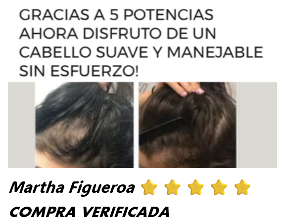 💯SERUM CAPILAR ⭐⭐⭐⭐⭐5 POTENCIAS🤩