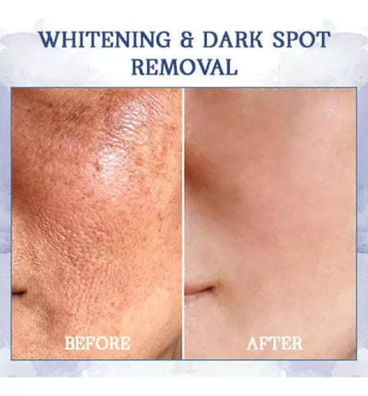💯🔥💫ANIVERSARIO DE REJUVENECIMIENTO: DESCUENTO EXCLUSIVO EN SKIN FIRMING💫🔥💯