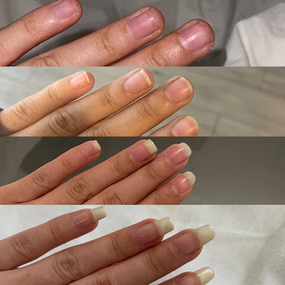 💅ENDURECEDOR DE UÑAS 4K POTENTE⭐⭐⭐⭐⭐ CRECIMIENTO🔝 & HONGOS💫